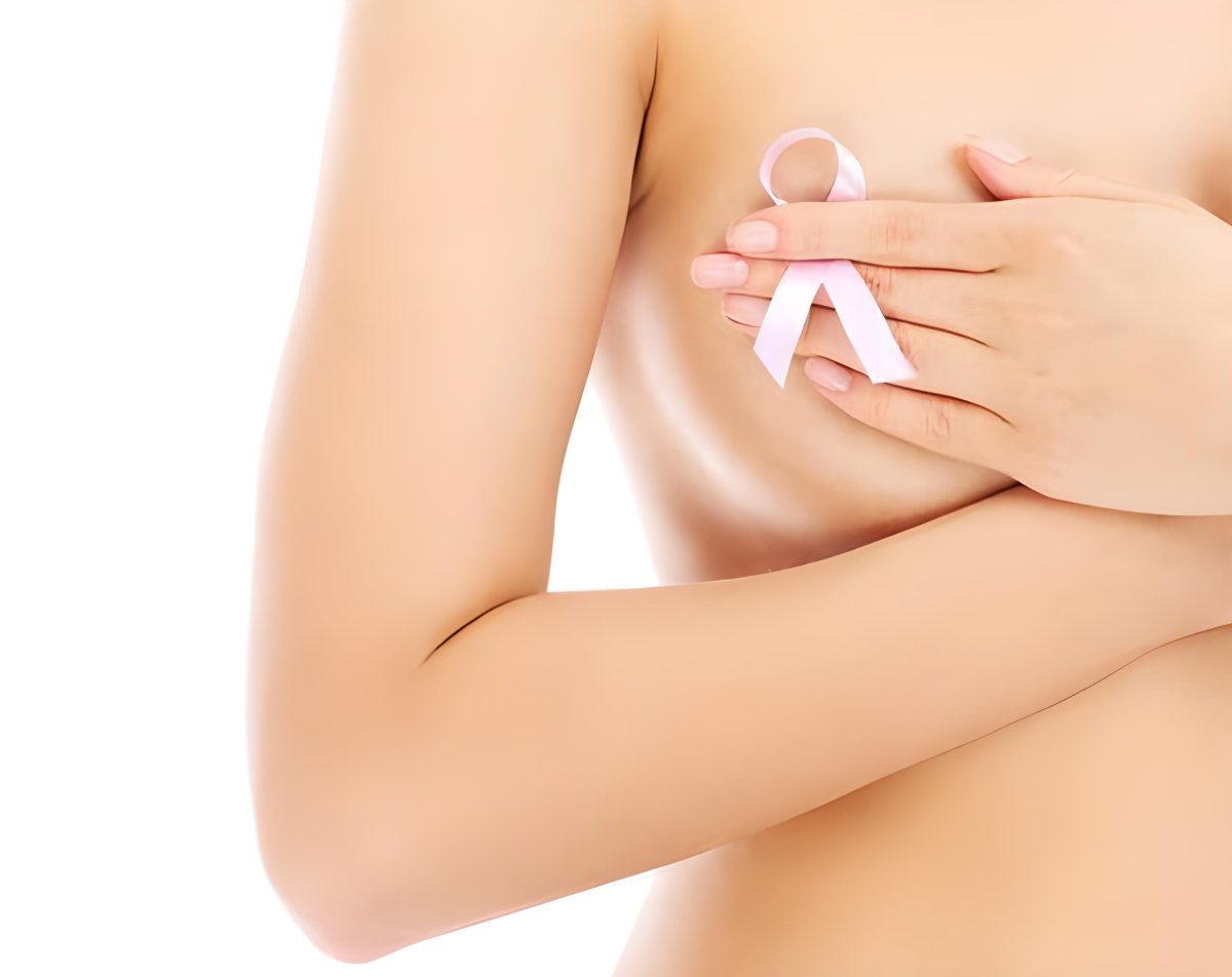 Cancer du sein héréditaire